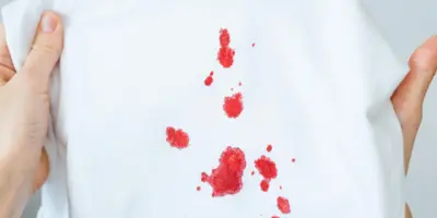 ¿Cómo quitar manchas de sangre de la ropa y sábanas?
